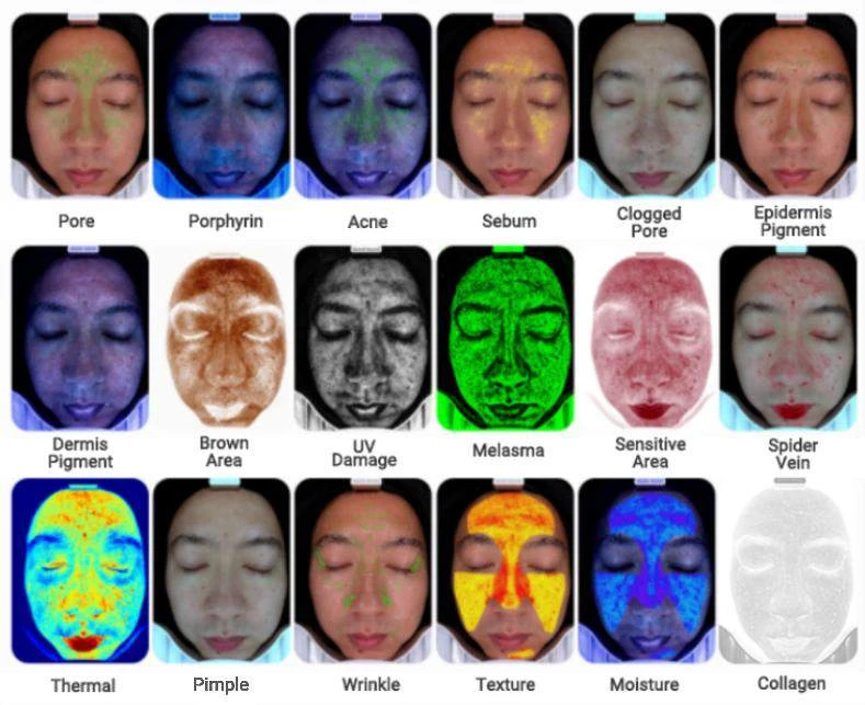 Comprehensive Skin Analysis